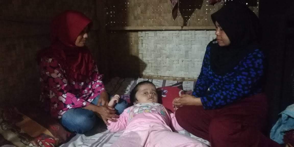 Tak Punya Biaya, Mirna Menderita Hydrocephalus Tak Mampu Berobat