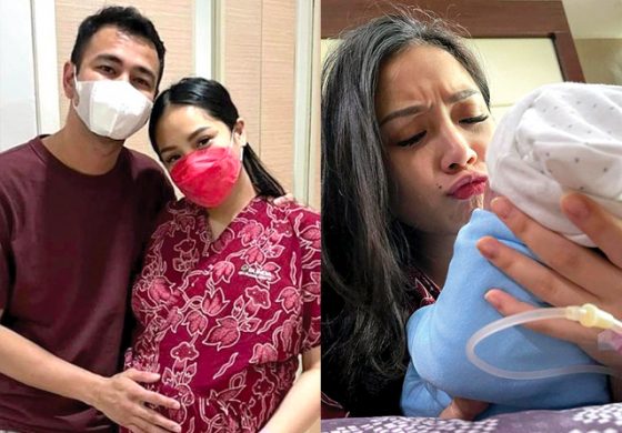 Melahirkan Anak Kedua dengan Caesar, Nagita Slavina Tetap Tampil Menawan