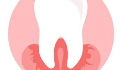Ngilu Banget! Ini, nih, Cara Ngobatin Gusi yang Nyeri dan Dijamin Ampuh! Sumber Ilustrasi via iStock