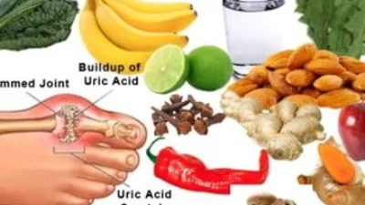 Beragam Pilihan Obat Herbal Untuk Asam Urat, Cek Obat Herbalnya disini!