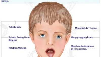 Apa itu Penyakit Difteri? Berikut Gejala, Pencegahan, Perawatan Medis yang Perlu Diketahui. (Sumber Gambar Infografis: dinkes.agamkab.go.id)