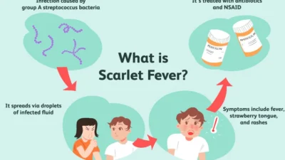 Demam Scarlet. (Sumber Infografis: Verywell Health)