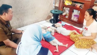 2 Bocah Idap Lumpuh Otak di Subang, Dinkes Ambil Langkah Bijak