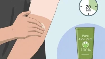 Tips Mengatasi Belang di Tangan. (Sumber Ilustrasi: Wikihow)