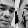 Penampakan Wajah Bro Ron Usai Dipukuli 2 Preman, Darah Mengucur di Pelipis Mata.